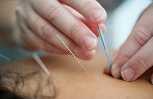 Allergy Relief Without Drugs