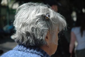 anti aging treatments