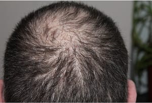 hair changes after 40